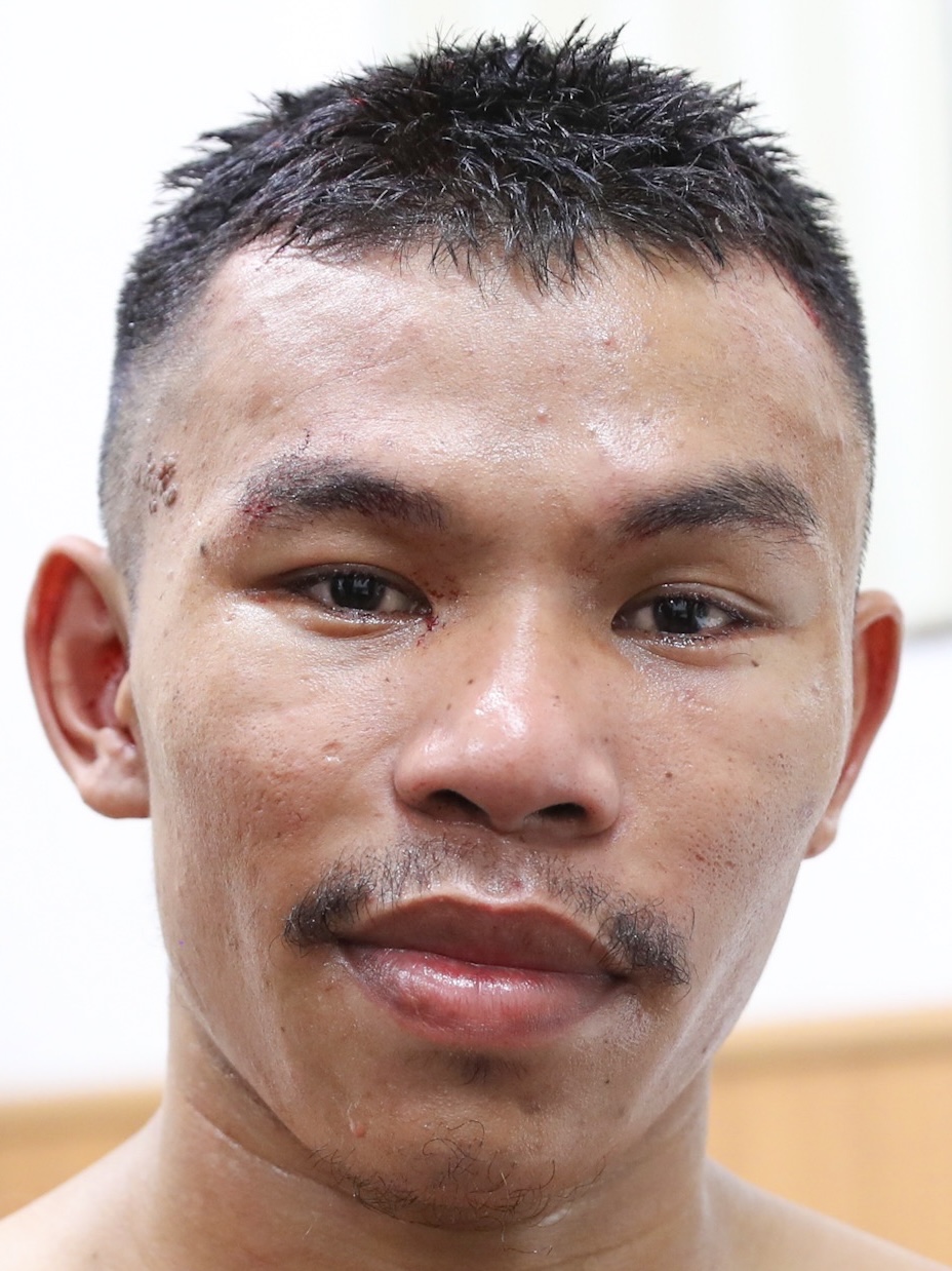 �A�h���A�� �f�����C�o�iAdrian Dulayba�j�I����