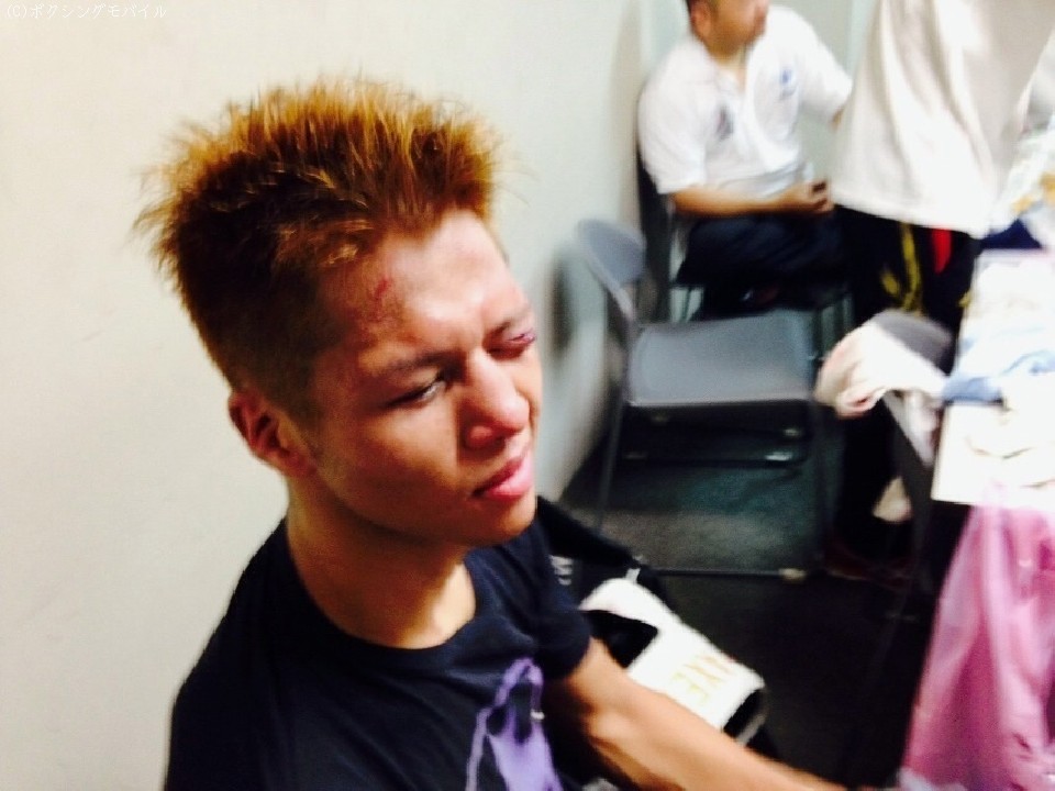 �A�N�Z���Z�g